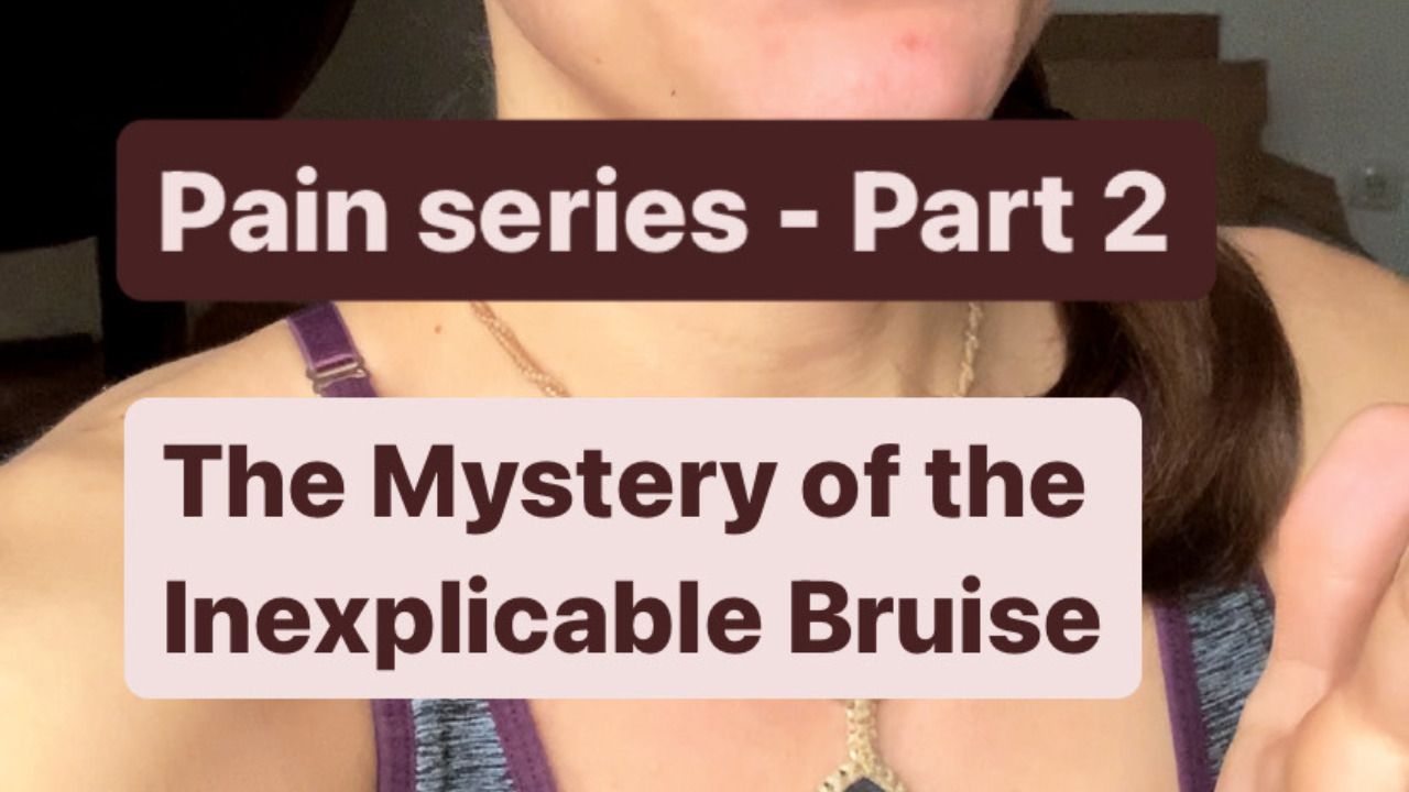 Pain series – Part 2: The Mystery of the Inexplicable Bruise